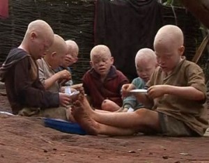 L&rsquo;Afrique et ses minorités : (1) Situation des Albinos en Afrique